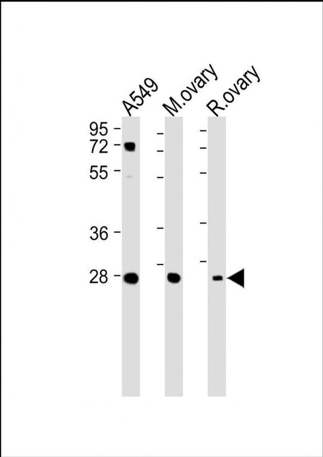 IGFBP4 Antibody in Western Blot (WB)