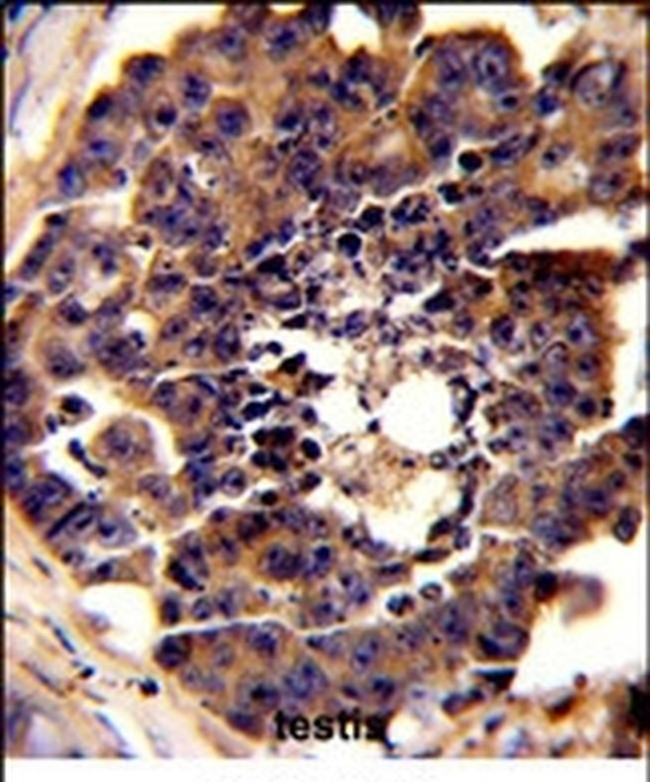 PDRG1 Antibody in Immunohistochemistry (IHC)