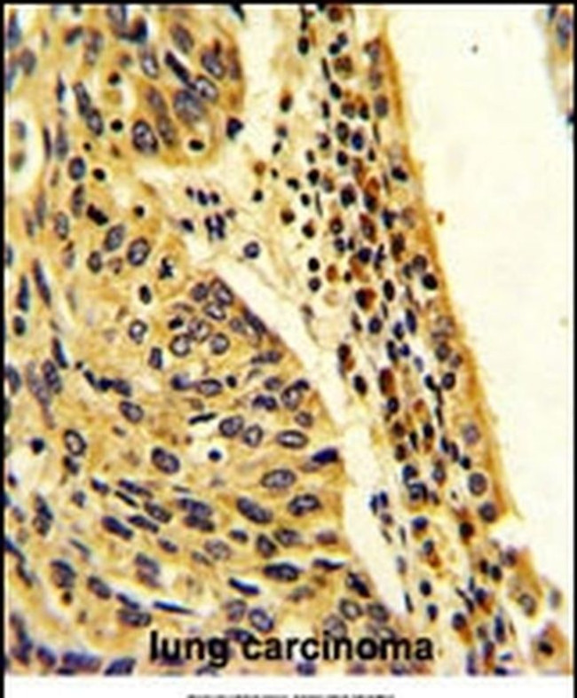 FPGS Antibody in Immunohistochemistry (IHC)