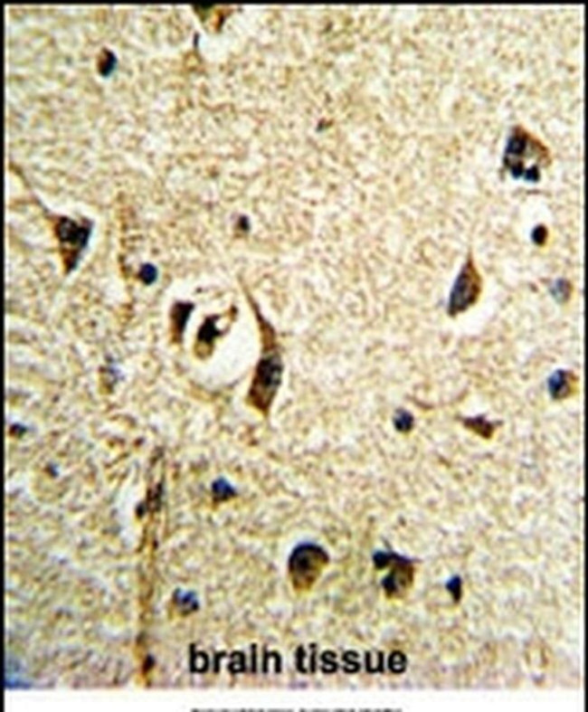 FTO Antibody in Immunohistochemistry (IHC)