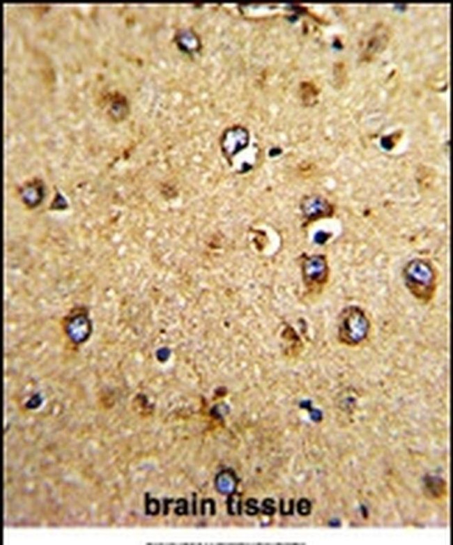 HOMER3 Antibody in Immunohistochemistry (IHC)