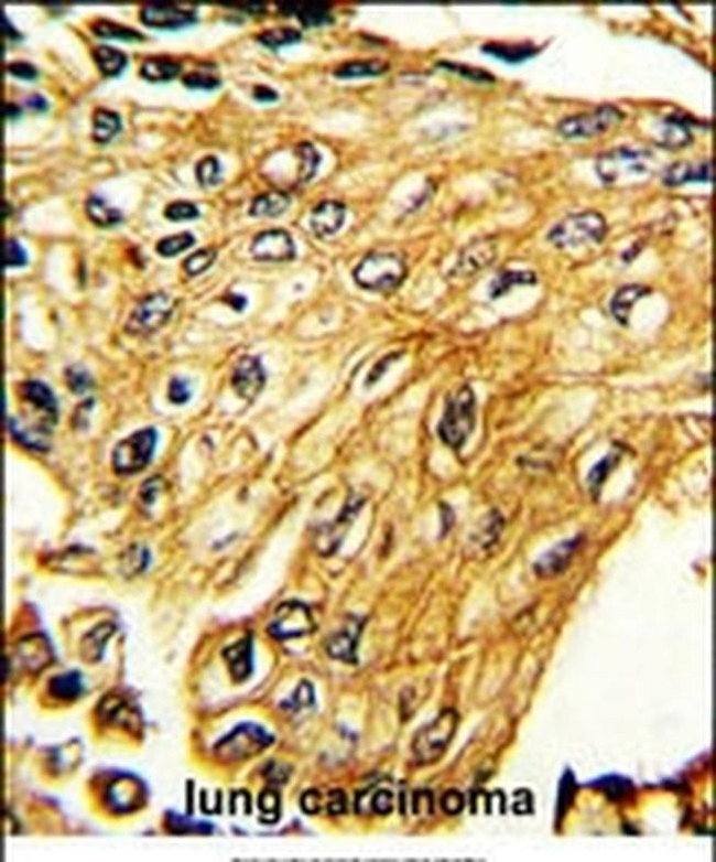 IFNGR2 Antibody in Immunohistochemistry (IHC)