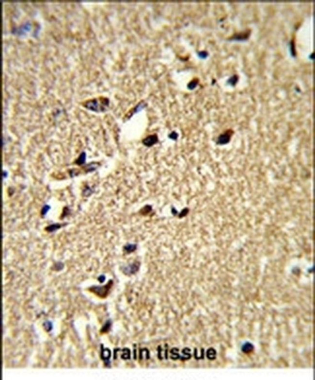 TSHZ1 Antibody in Immunohistochemistry (IHC)
