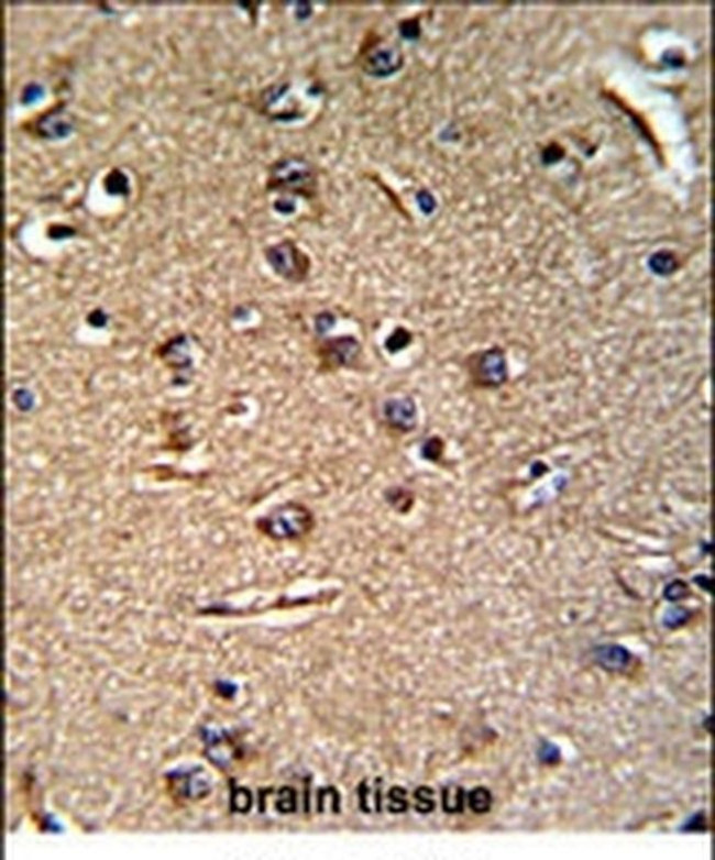 GGT5 Antibody in Immunohistochemistry (IHC)