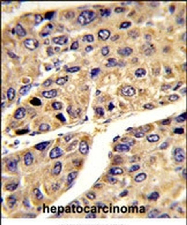 ALS Antibody in Immunohistochemistry (IHC)