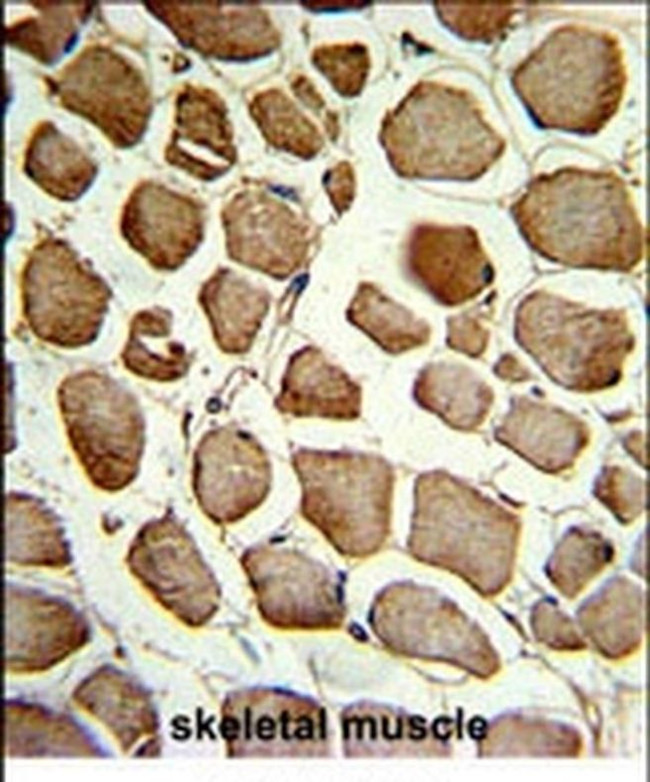 PLEKHO1 Antibody in Immunohistochemistry (IHC)