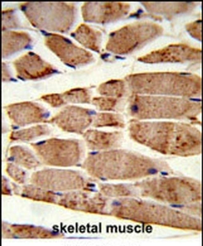 RANBP9 Antibody in Immunohistochemistry (IHC)