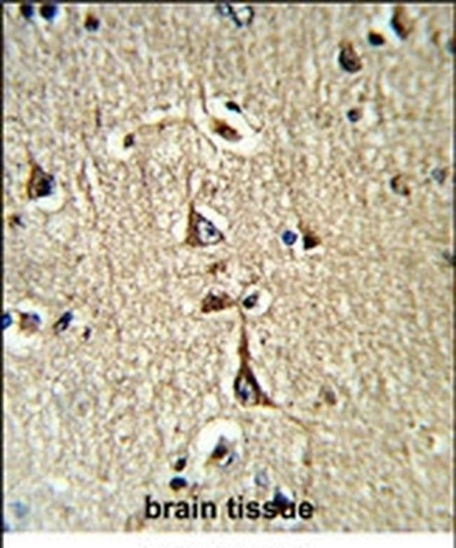GPD1 Antibody in Immunohistochemistry (IHC)