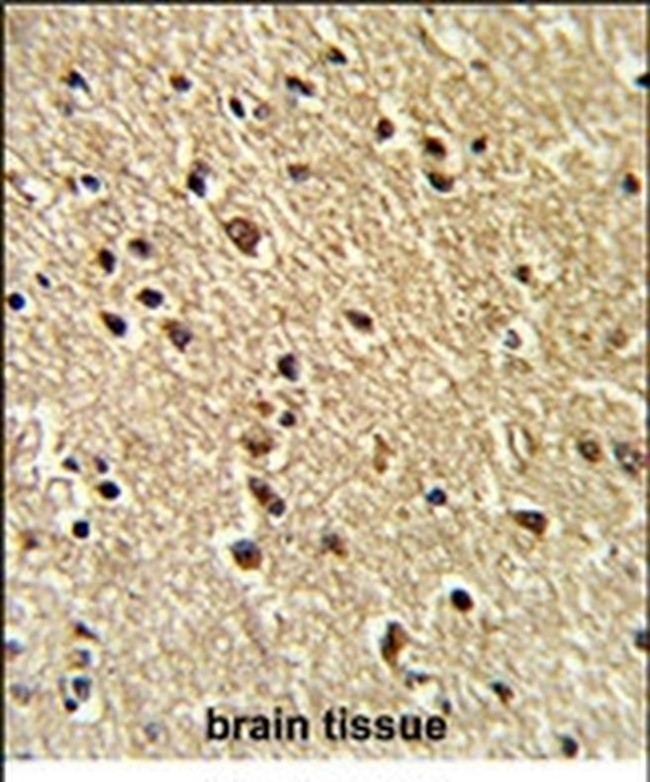 ZNF823 Antibody in Immunohistochemistry (IHC)