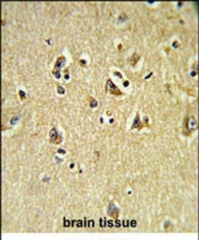 VPS53 Antibody in Immunohistochemistry (IHC)