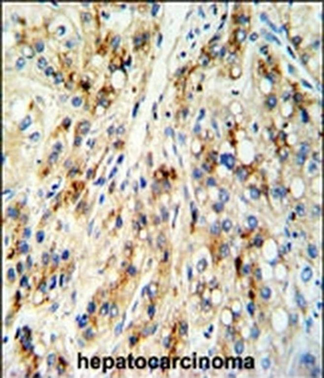 CECR5 Antibody in Immunohistochemistry (IHC)