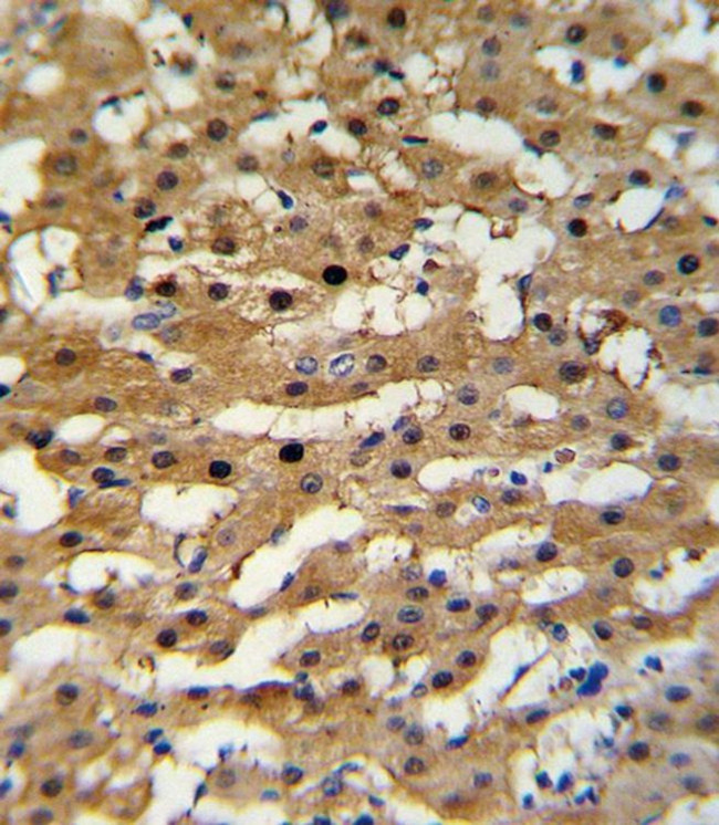 ADH5 Antibody in Immunohistochemistry (IHC)