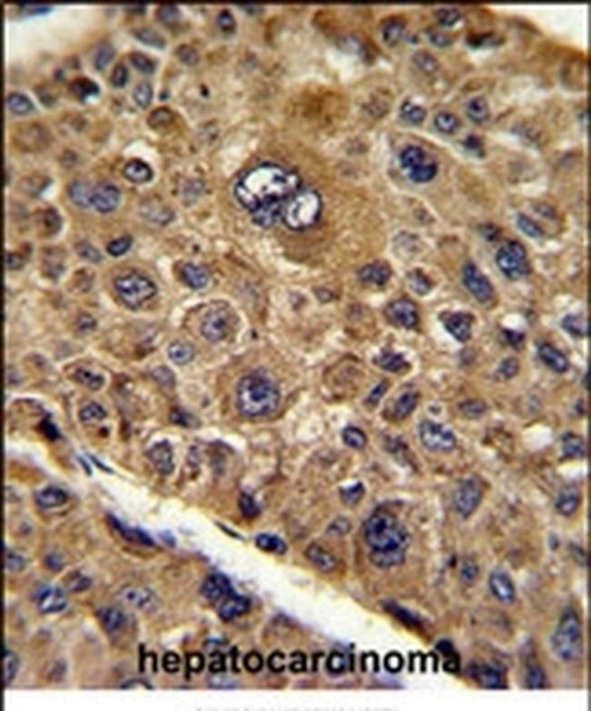 TOB1 Antibody in Immunohistochemistry (IHC)