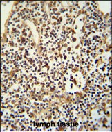 ANO5 Antibody in Immunohistochemistry (Paraffin) (IHC (P))