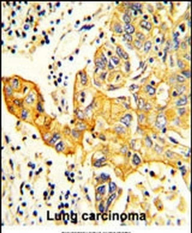 RARS2 Antibody in Immunohistochemistry (IHC)