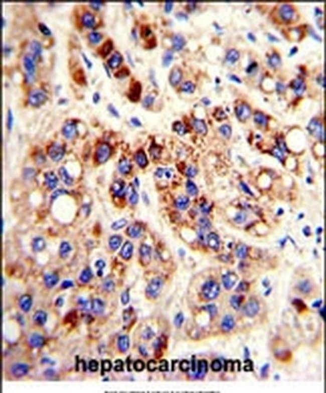PON3 Antibody in Immunohistochemistry (IHC)