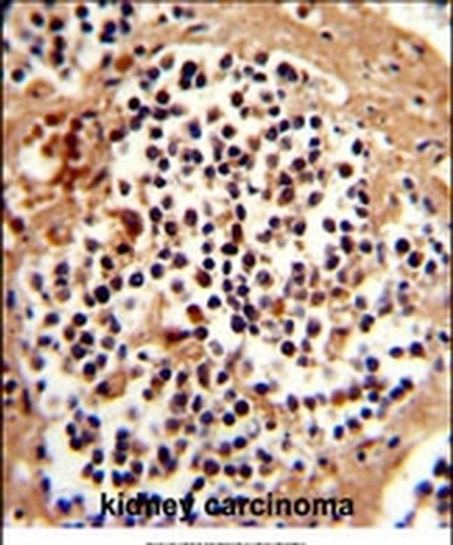 SERPINB7 Antibody in Immunohistochemistry (IHC)