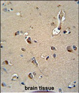 MPZ Antibody in Immunohistochemistry (Paraffin) (IHC (P))
