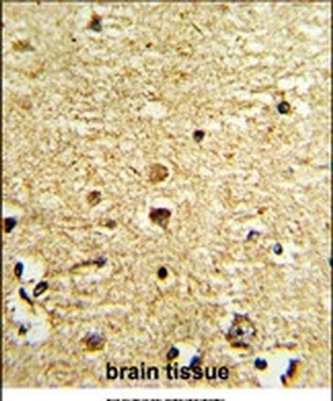 OLIG3 Antibody in Immunohistochemistry (IHC)