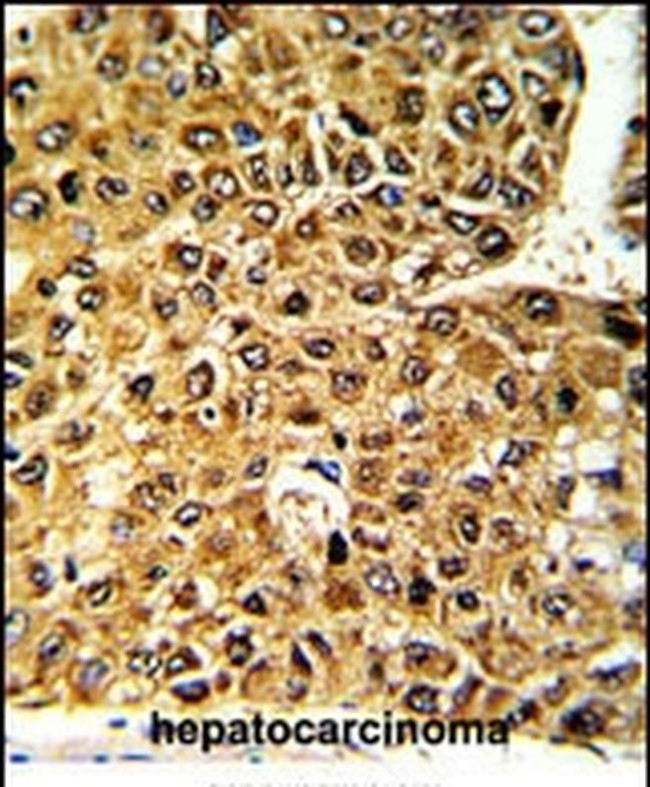 MLX Antibody in Immunohistochemistry (IHC)