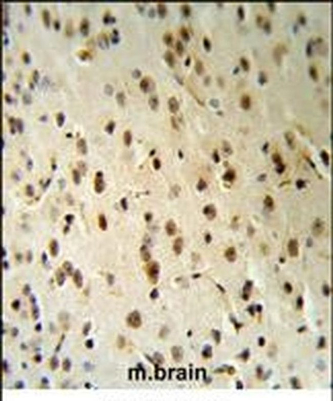 TARSL2 Antibody in Immunohistochemistry (IHC)