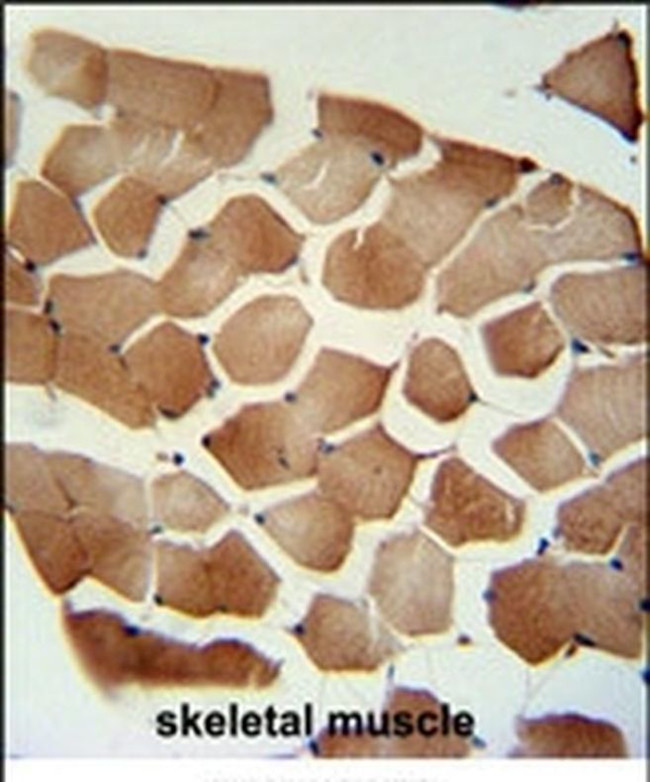 Folliculin Antibody in Immunohistochemistry (IHC)