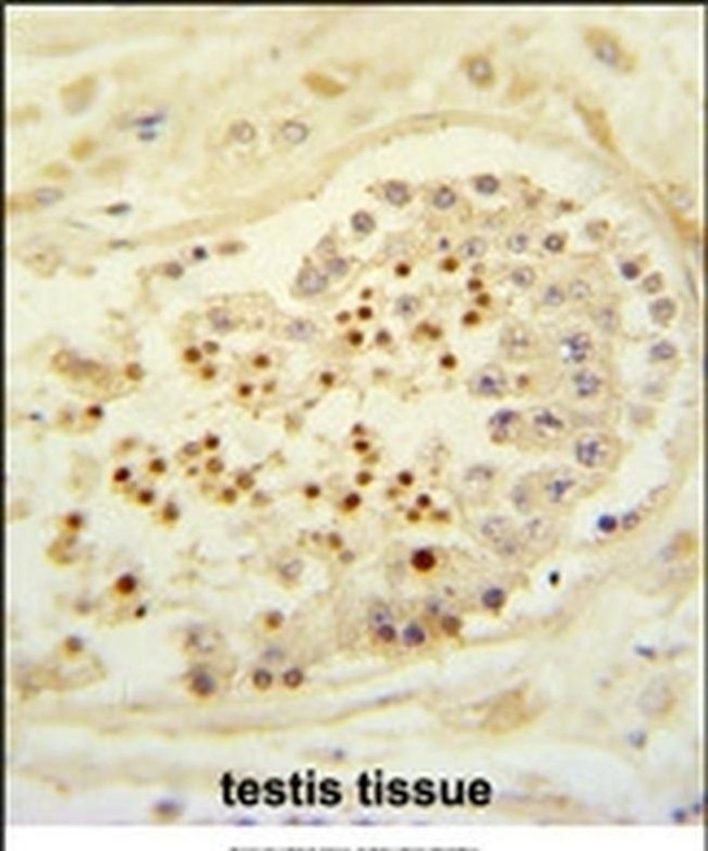 Cbl-b Antibody in Immunohistochemistry (IHC)