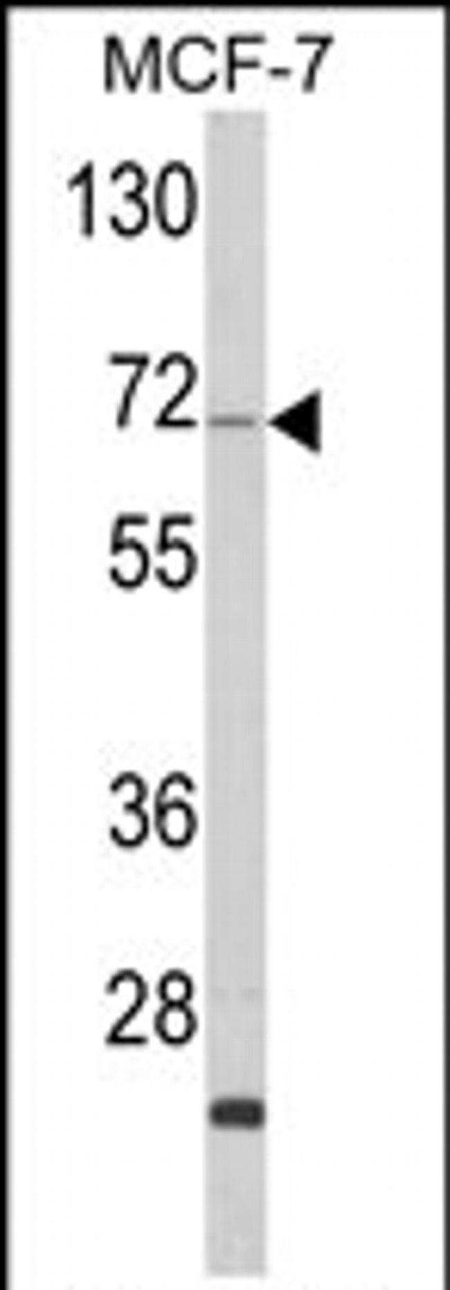ZYG11A Antibody in Western Blot (WB)