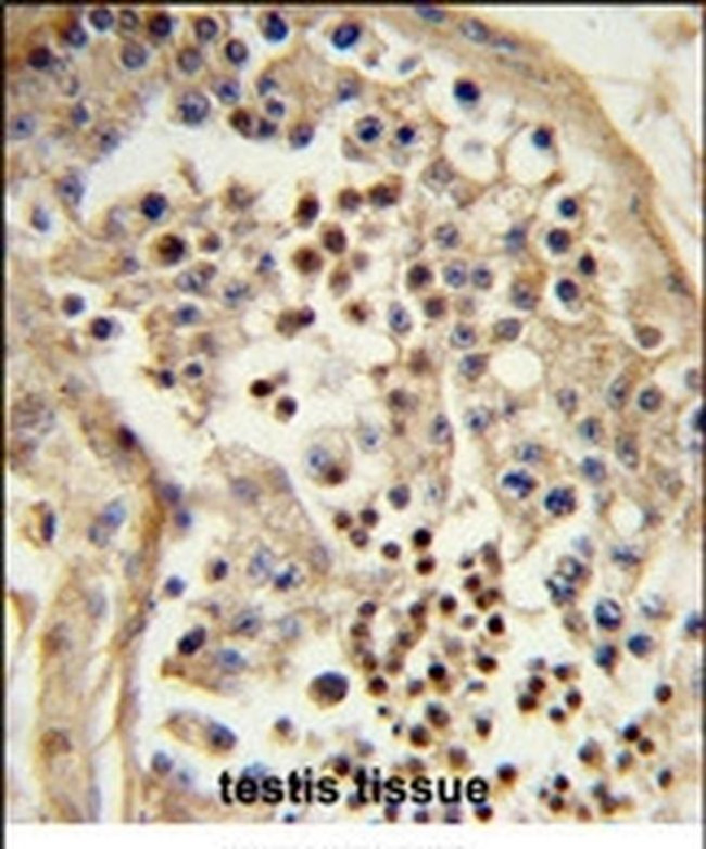TBATA Antibody in Immunohistochemistry (IHC)