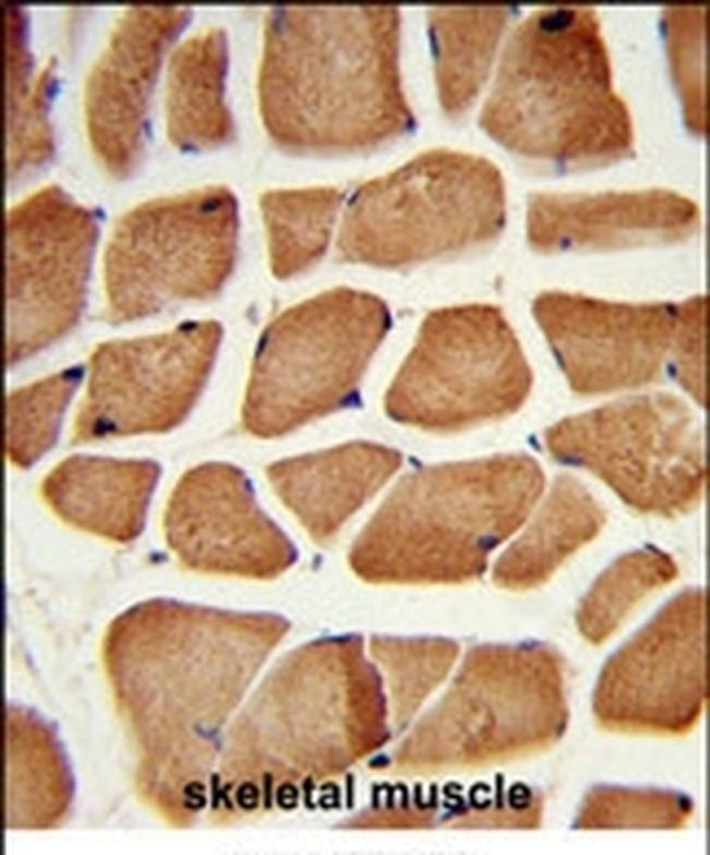 PECI Antibody in Immunohistochemistry (IHC)