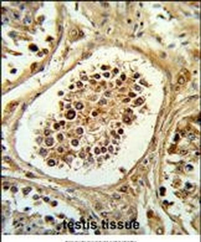 PHD1 Antibody in Immunohistochemistry (IHC)