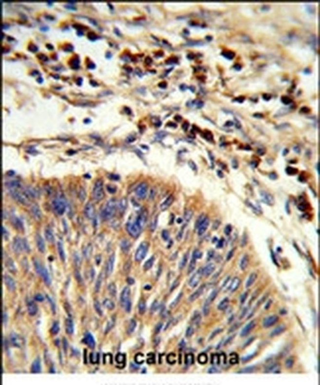 HSPA6 Antibody in Immunohistochemistry (IHC)