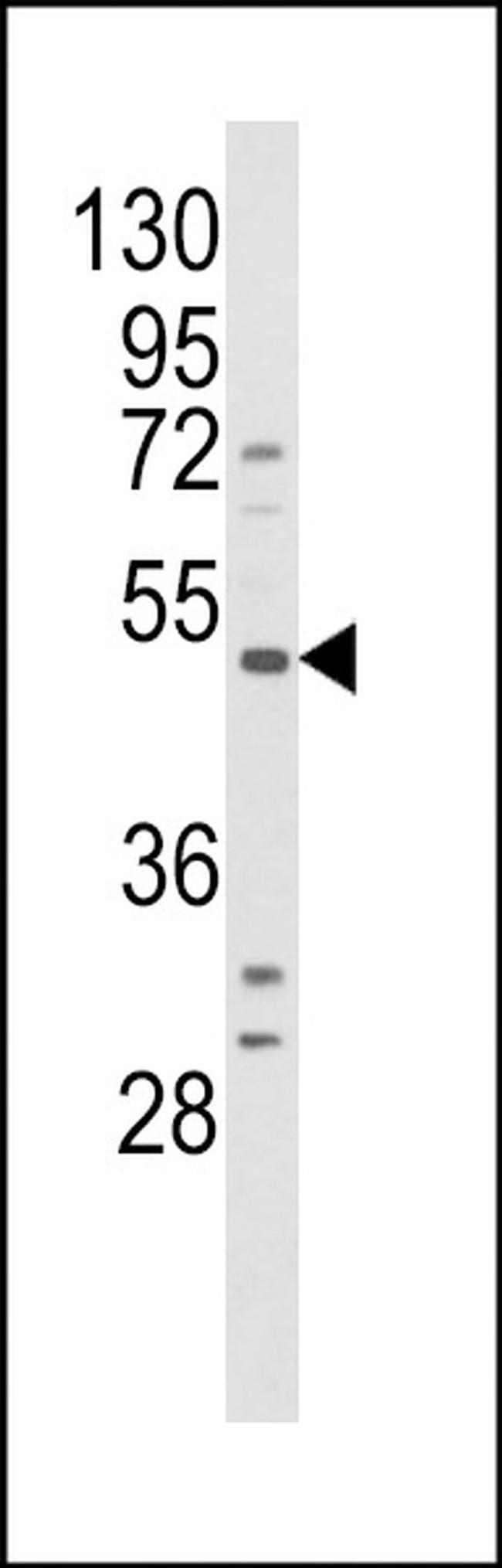 B1 Bradykinin Receptor Antibody in Western Blot (WB)