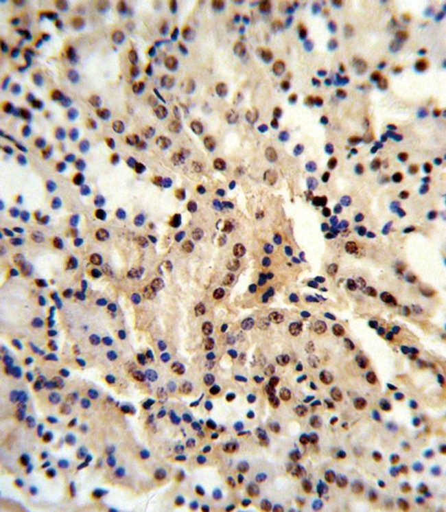 UAP56 Antibody in Immunohistochemistry (IHC)