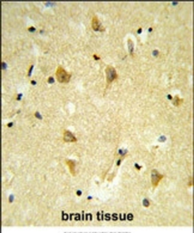 MPV17 Antibody in Immunohistochemistry (IHC)