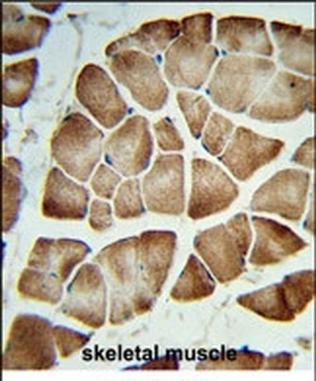 COQ3 Antibody in Immunohistochemistry (IHC)