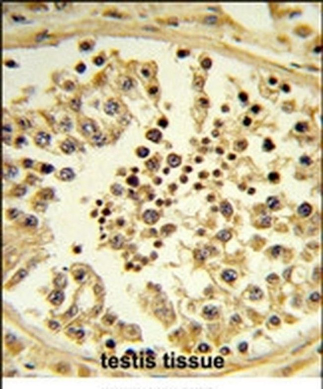 Importin 11 Antibody in Immunohistochemistry (IHC)
