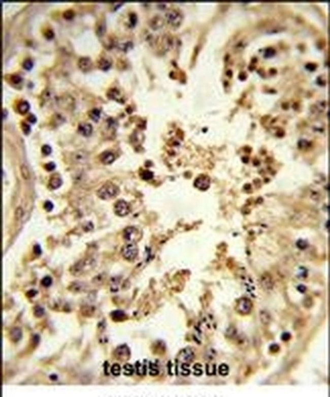 Cdc42EP3 Antibody in Immunohistochemistry (IHC)