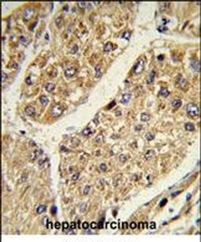 CSGALNACT2 Antibody in Immunohistochemistry (IHC)