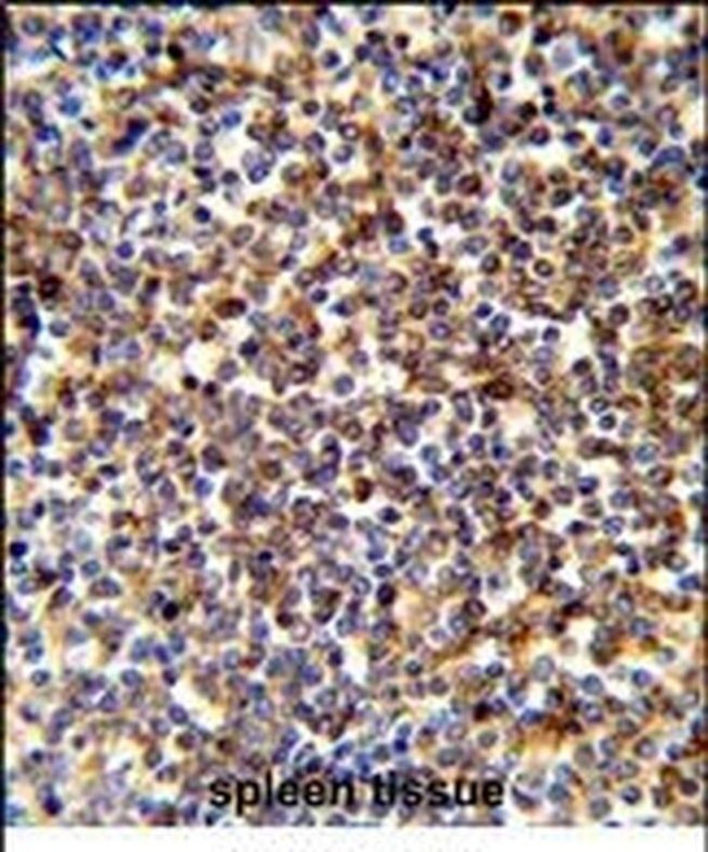 COTL1 Antibody in Immunohistochemistry (IHC)