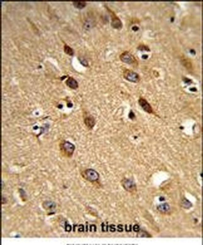 PISD Antibody in Immunohistochemistry (IHC)