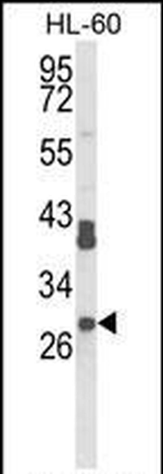 RPS8 Antibody in Western Blot (WB)