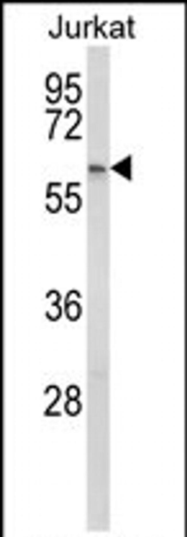 PCCB Antibody in Western Blot (WB)