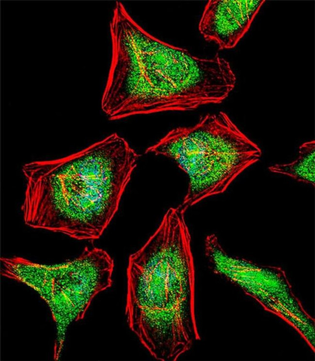 ATF7 Antibody in Immunocytochemistry (ICC/IF)