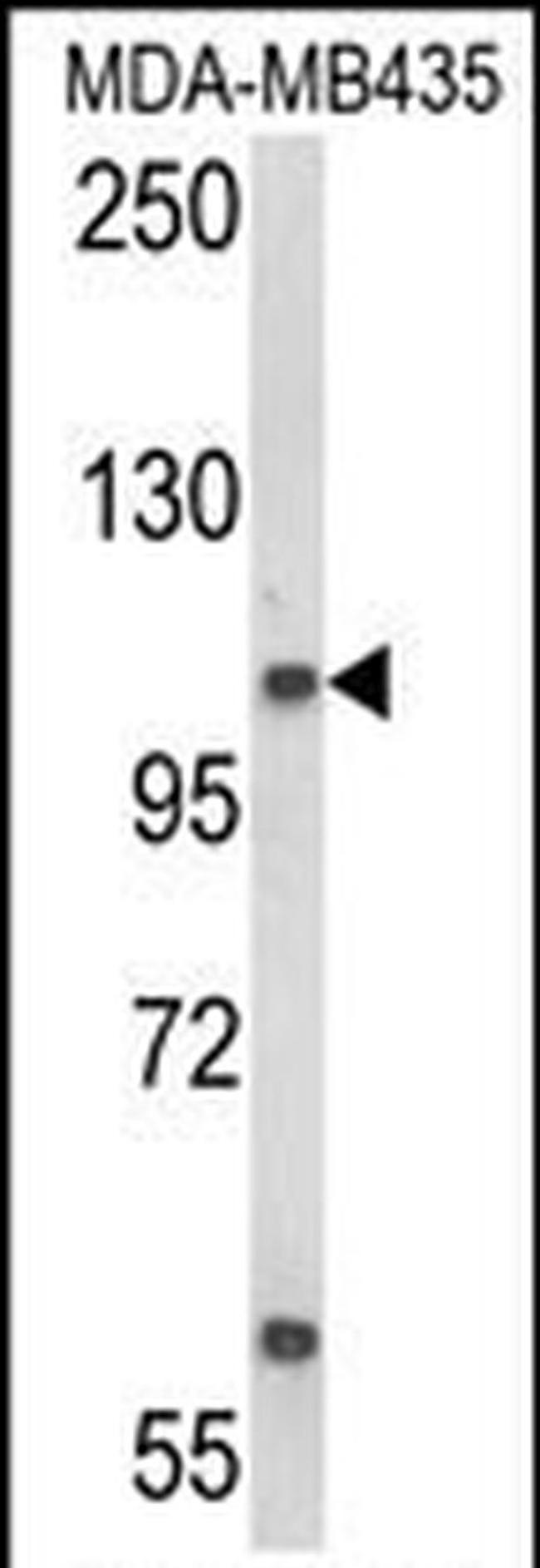 CASD1 Antibody in Western Blot (WB)