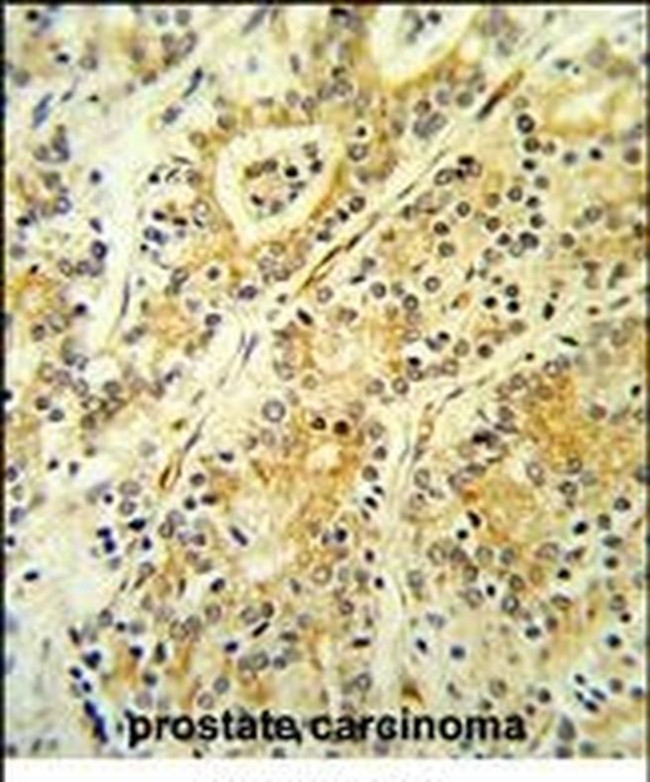 MGST2 Antibody in Immunohistochemistry (IHC)