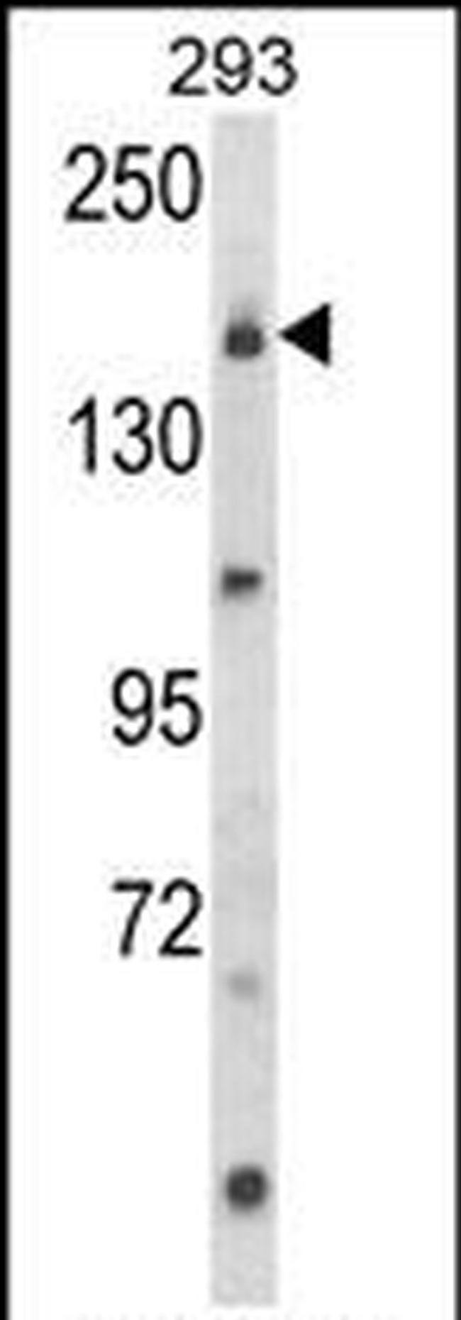 UNC13B Antibody in Western Blot (WB)