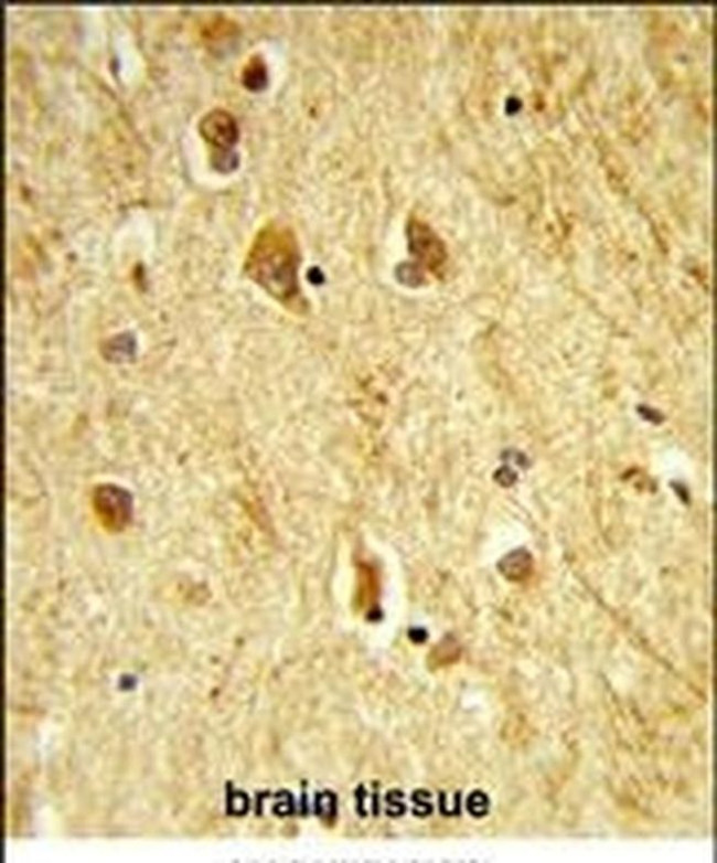 ADAMTS18 Antibody in Immunohistochemistry (IHC)