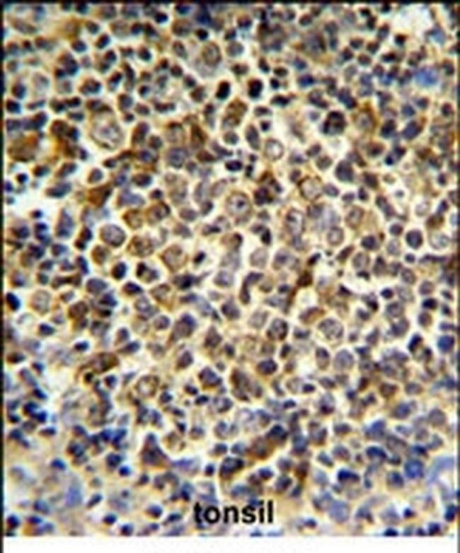 KIR2DL5B Antibody in Immunohistochemistry (IHC)