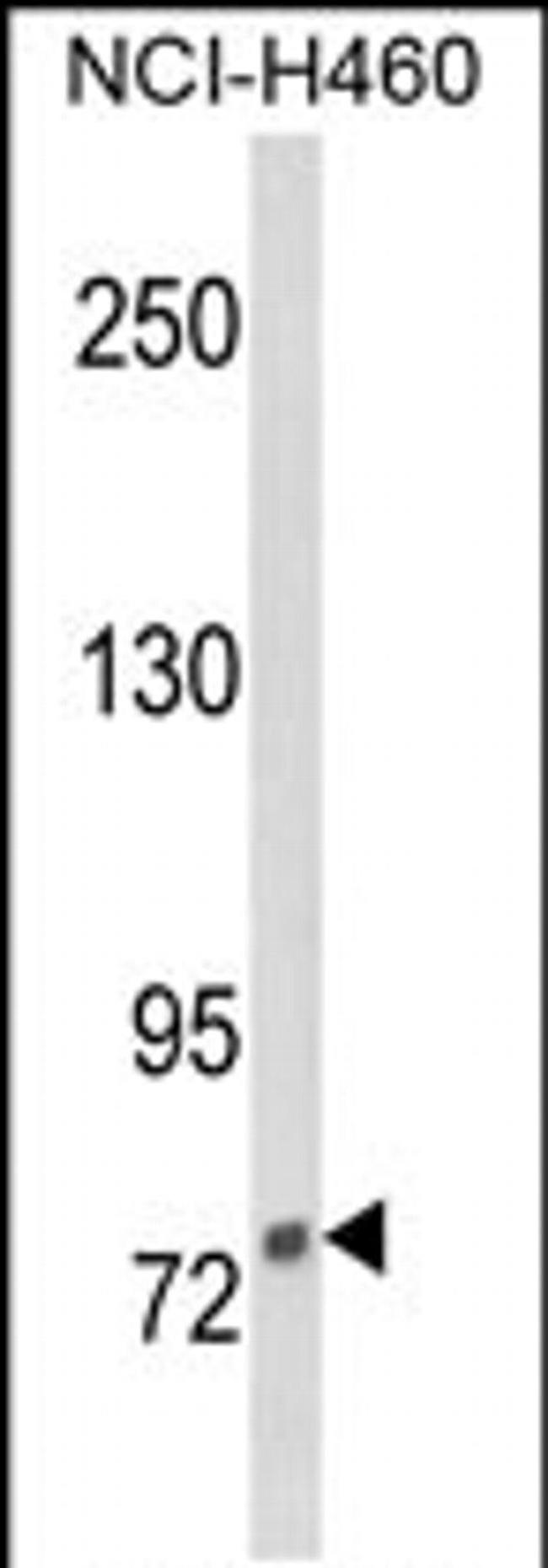 DGCR8 Antibody in Western Blot (WB)